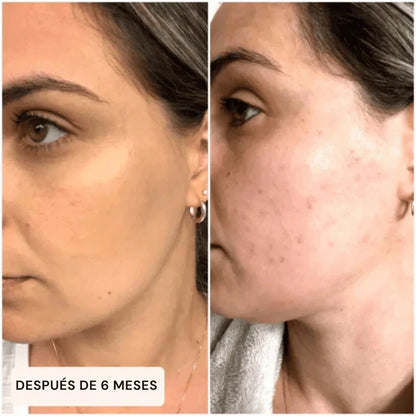 Smoothia™ – Guante Exfoliante para Cuerpo y Rostro