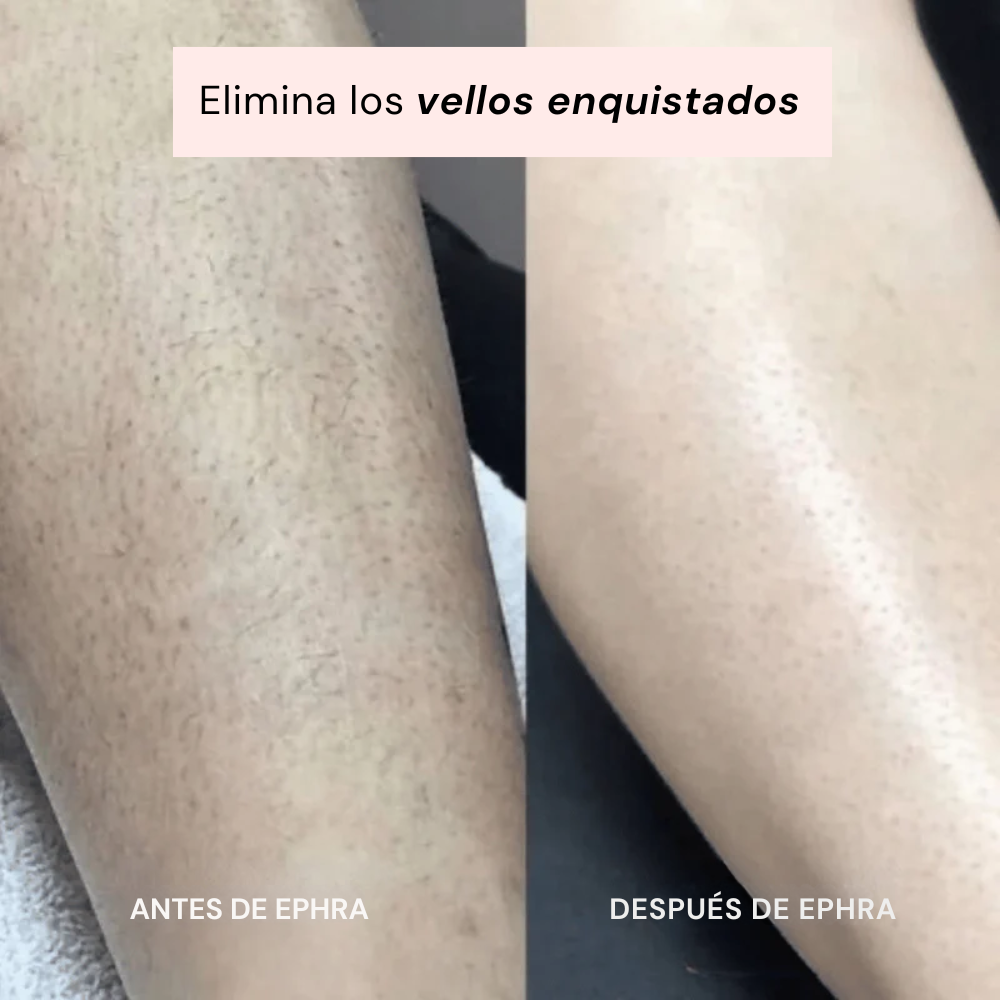 Smoothia – Afeitadora Íntima