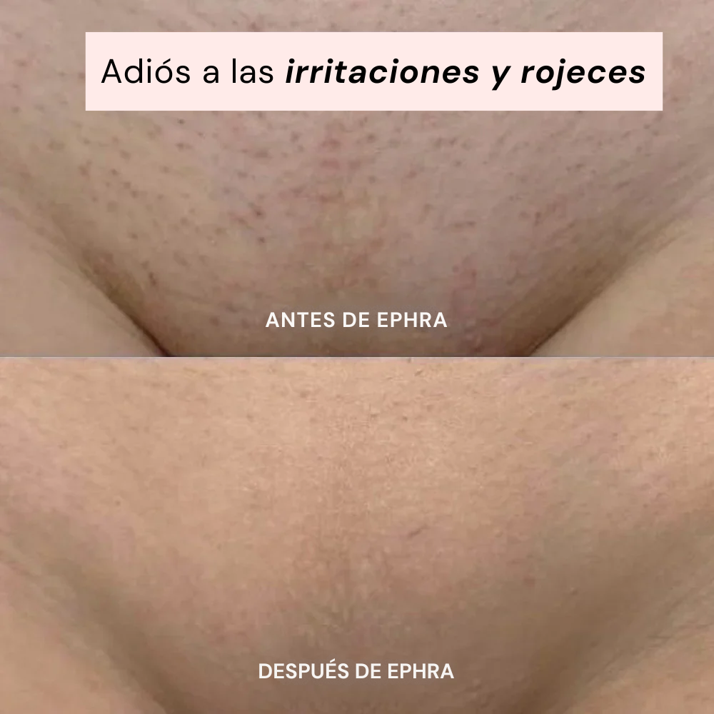Smoothia – Afeitadora Íntima