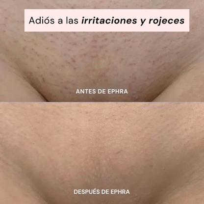 Smoothia – Afeitadora Íntima